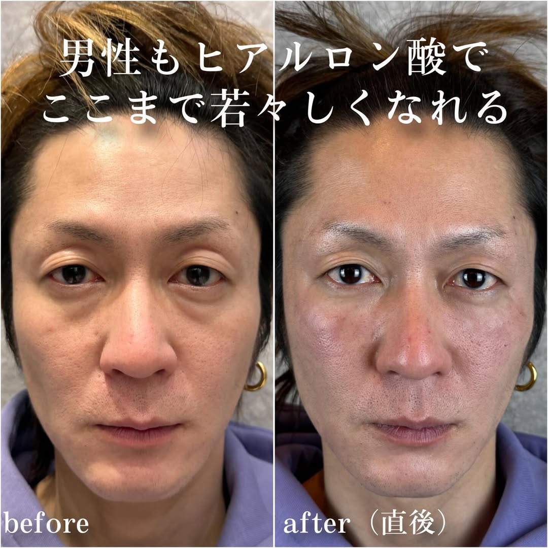 No.13813の症例写真