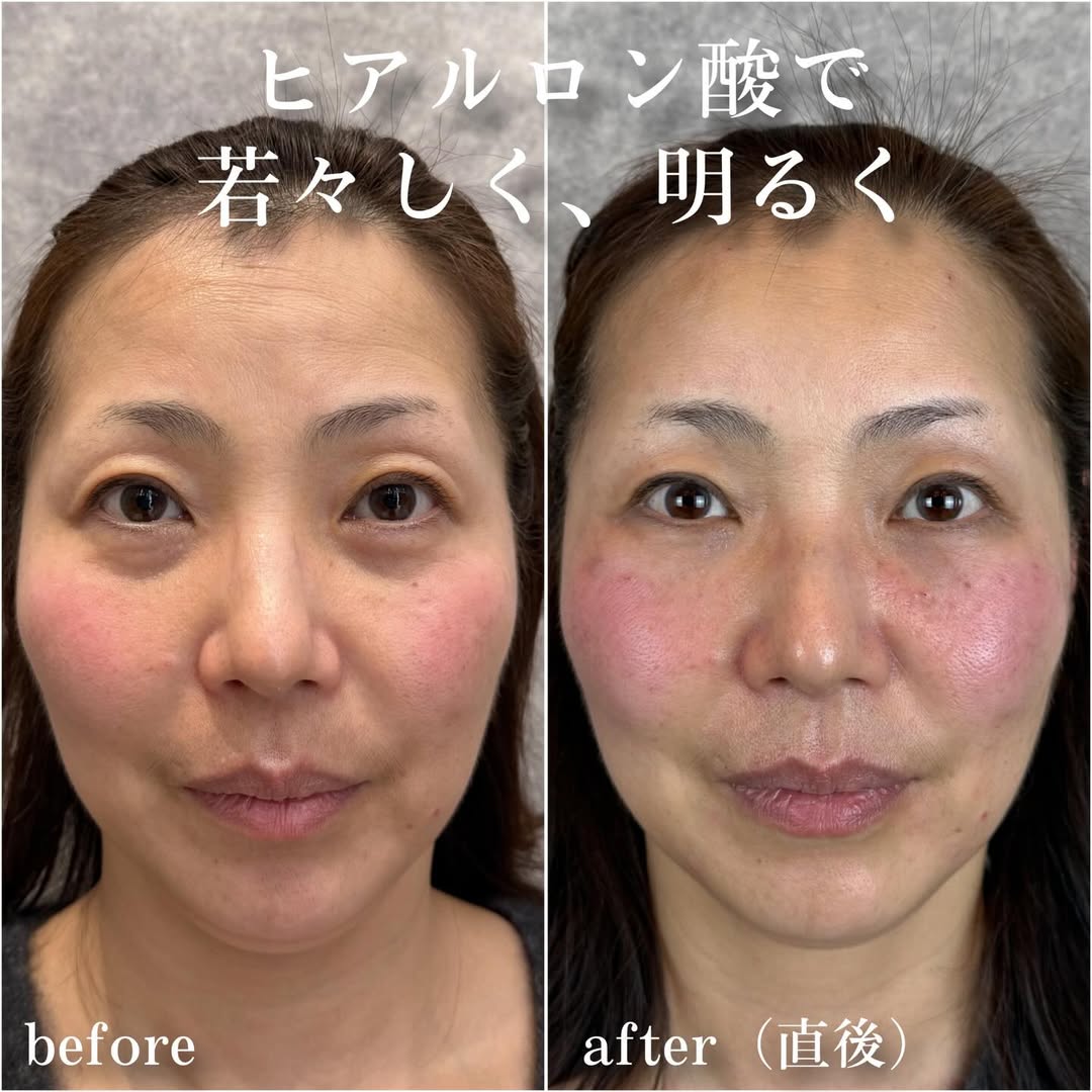 No.13784の症例写真