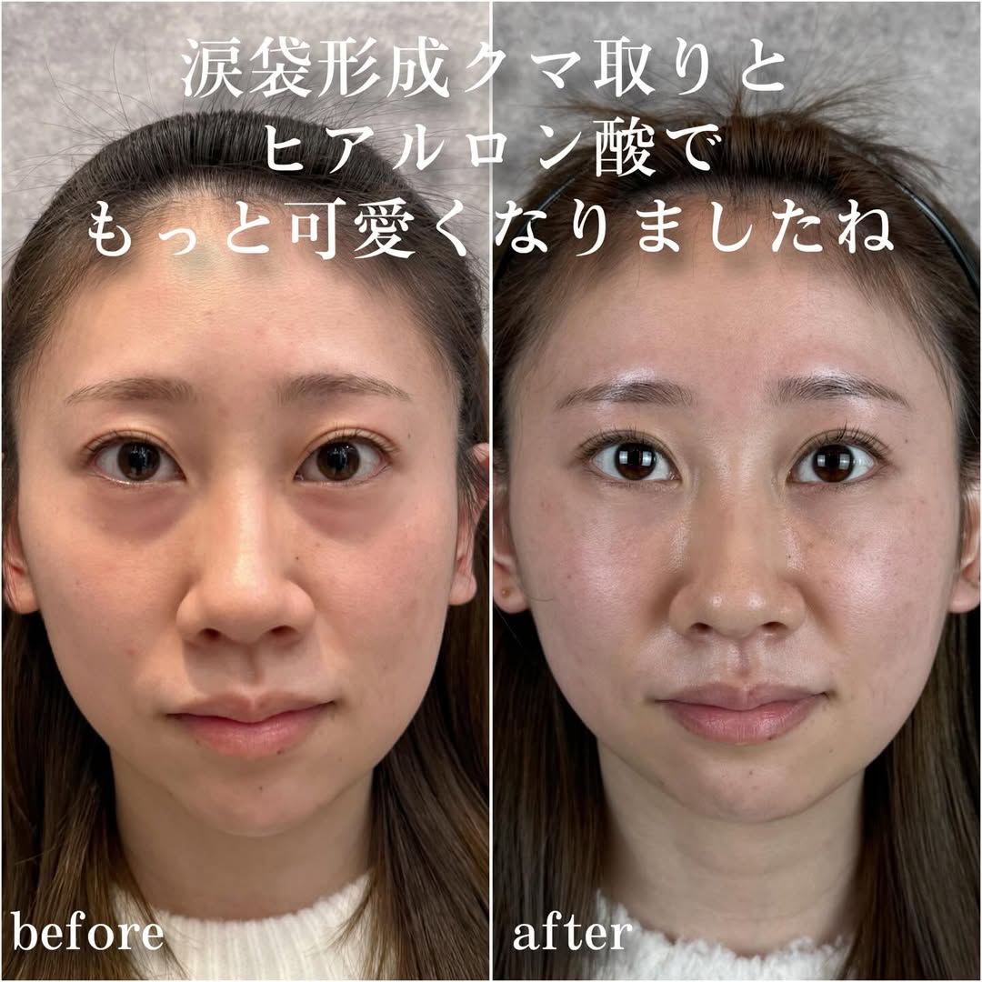 No.13803の症例写真