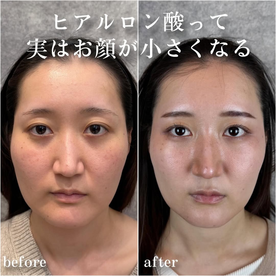 No.13808の症例写真