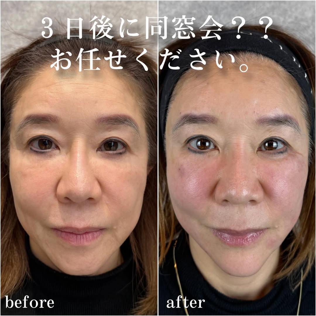 No.13896の症例写真