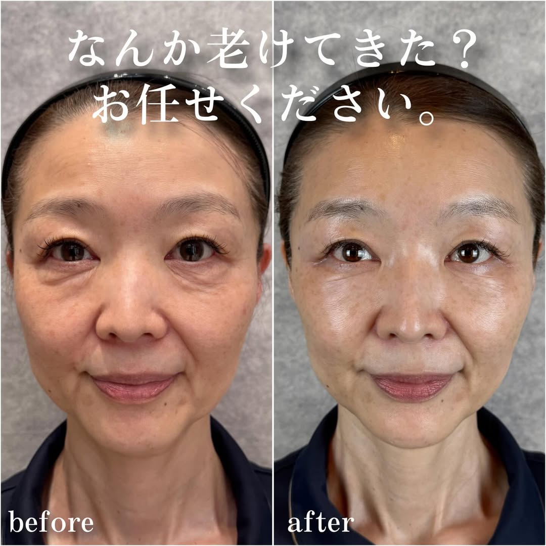 No.13927の症例写真