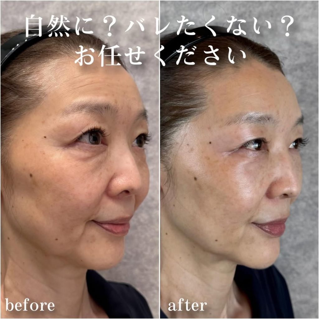 ビフォーアフター