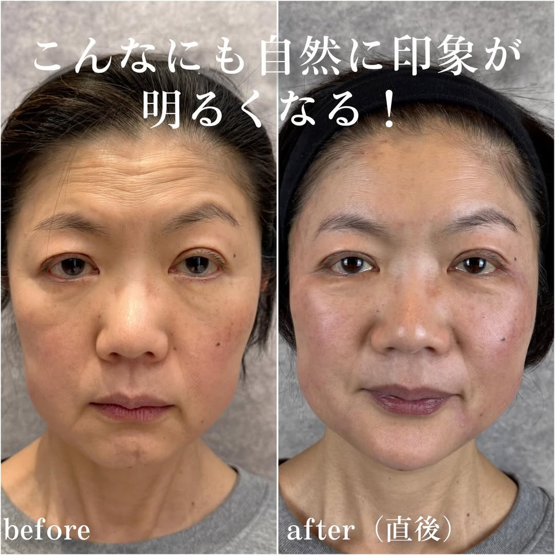 No.13821の症例写真