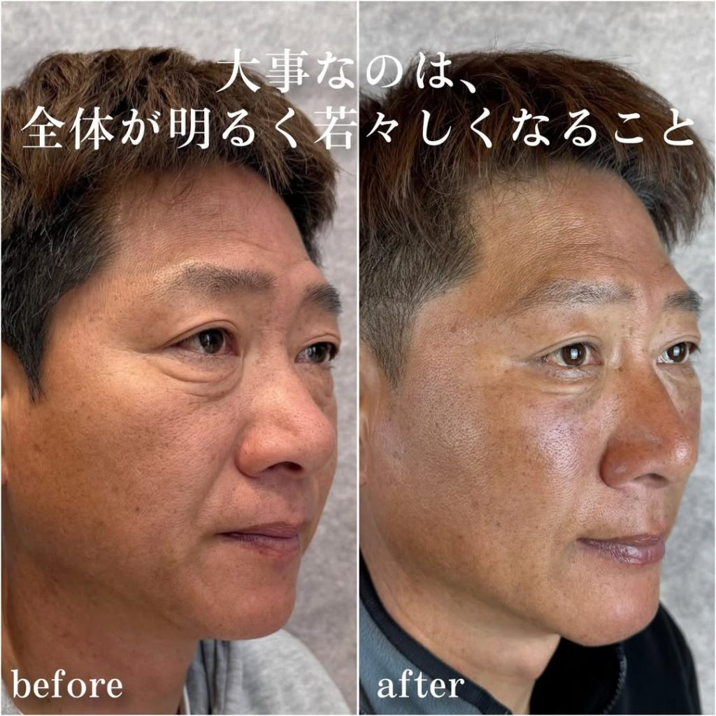 ビフォーアフター