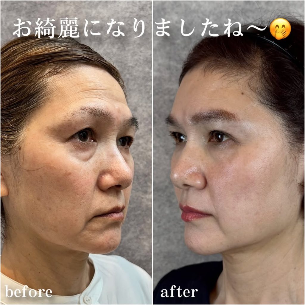 ビフォーアフター