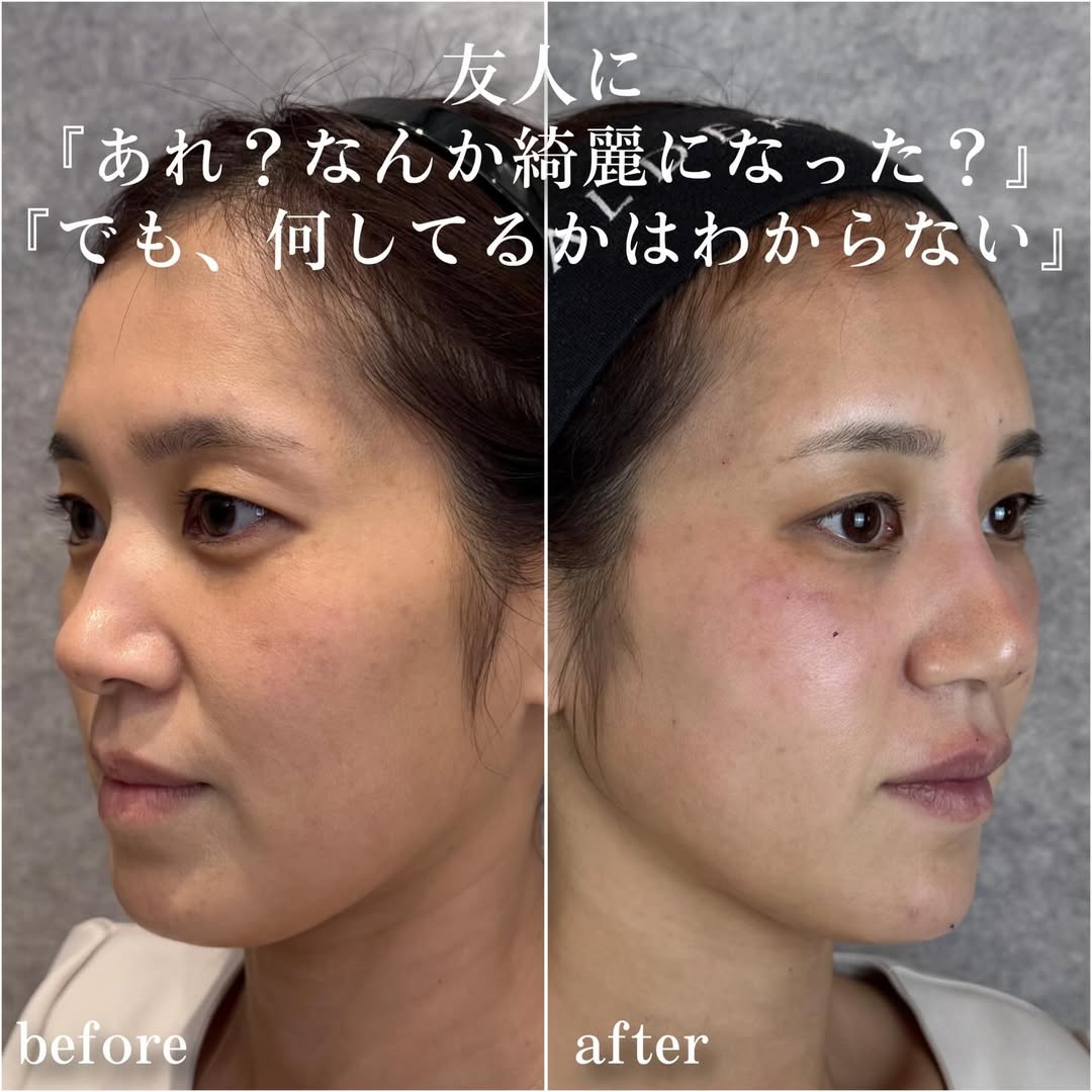 No.13973の症例写真