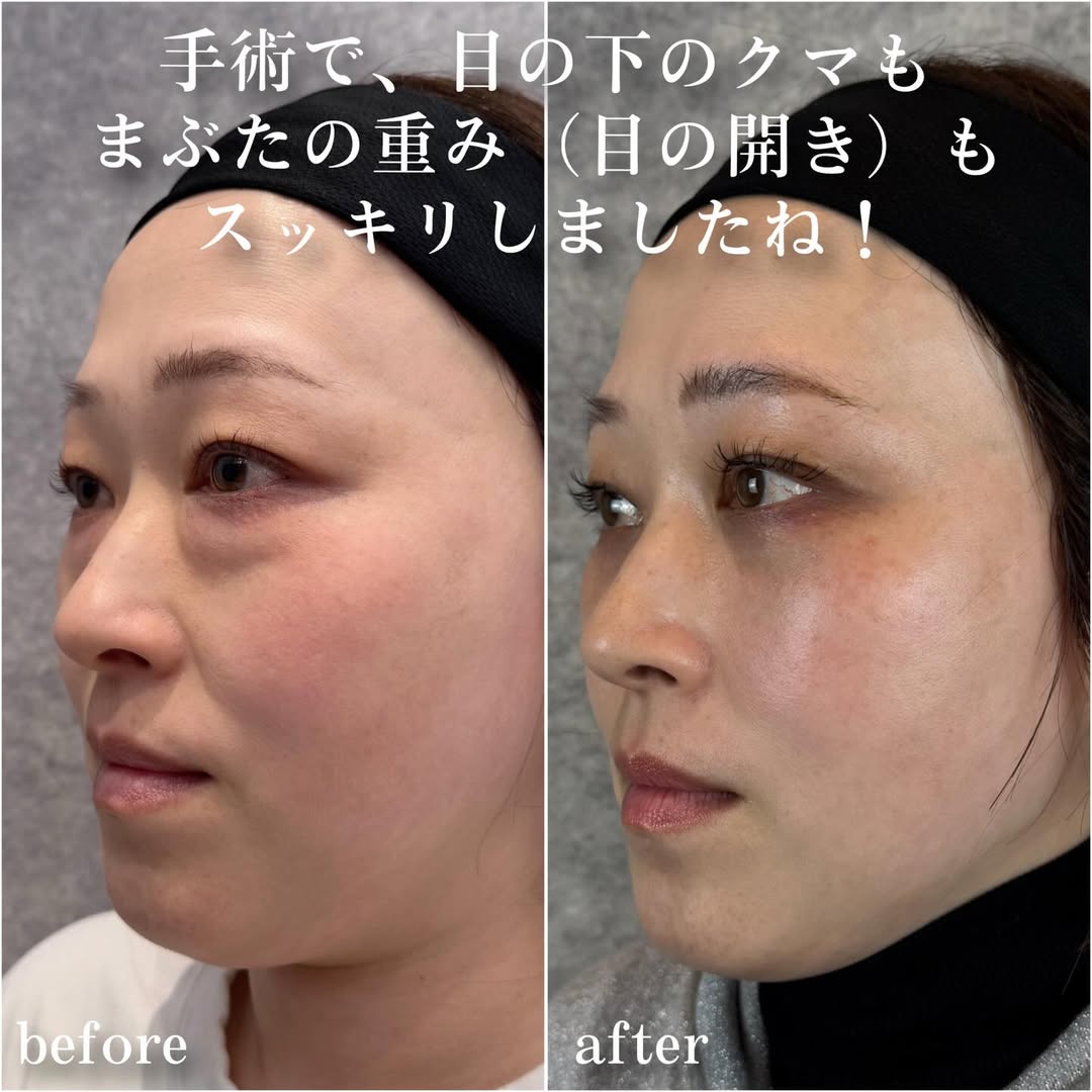 No.14028の症例写真