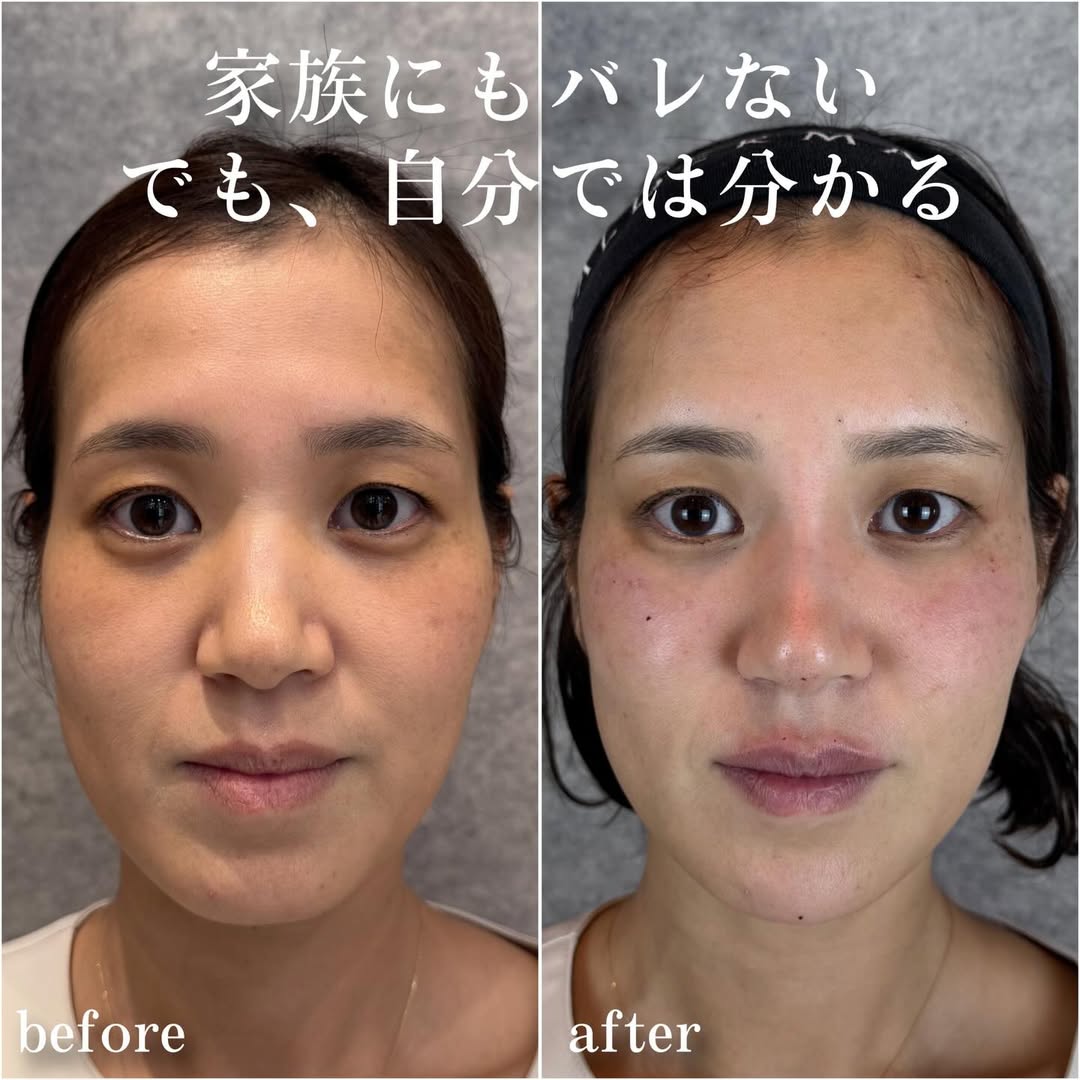 No.13978の症例写真