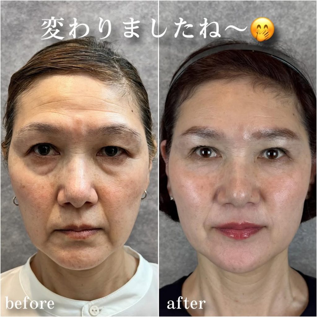 ビフォーアフター