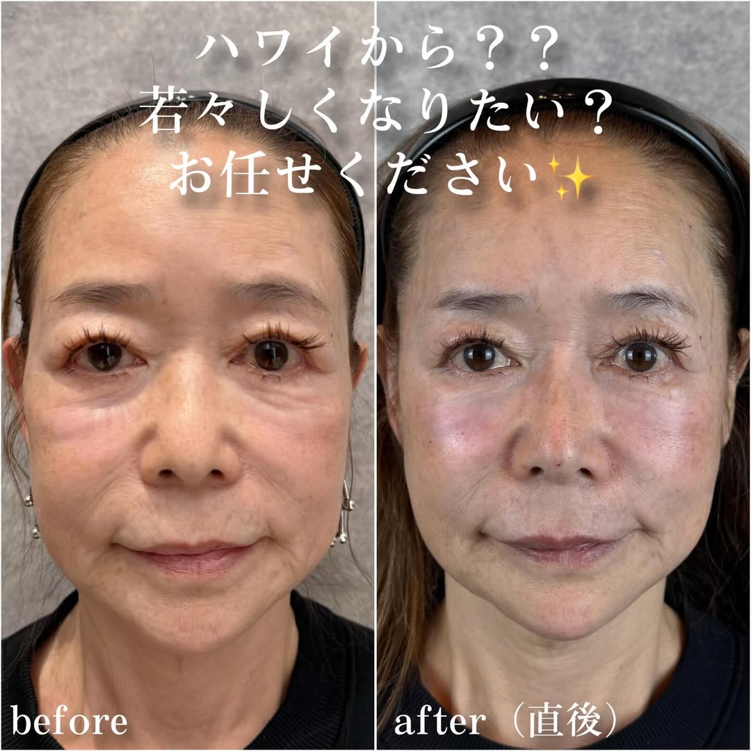 No.14036の症例写真