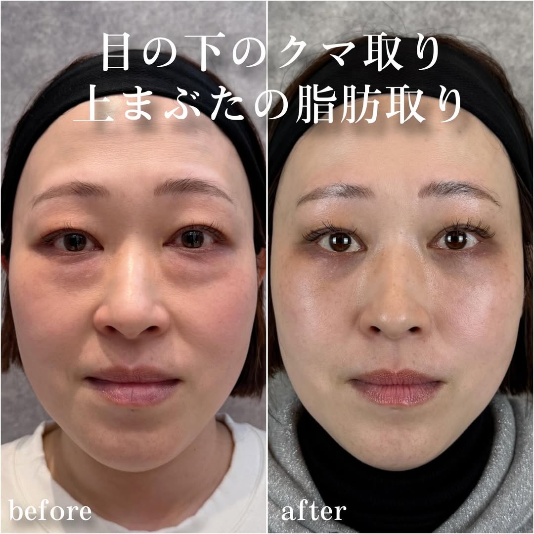 No.14023の症例写真