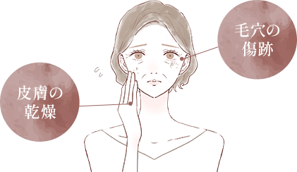 皮膚の乾燥/毛穴の傷跡