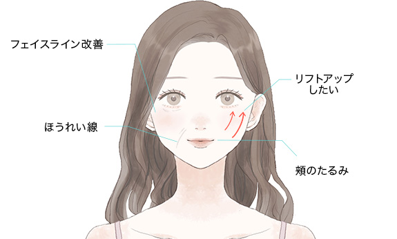 糸リフトはこんなお悩みをお持ちの方に