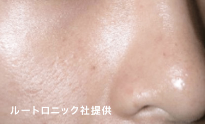 デュアルピール