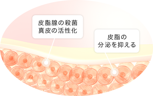スペクトラピールの仕組み