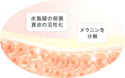 デュアルピールの仕組み