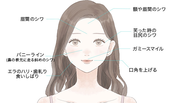 ボトックス治療こんなお悩みをお持ちの方に