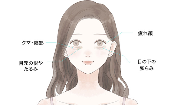 ボトックス治療こんなお悩みをお持ちの方に