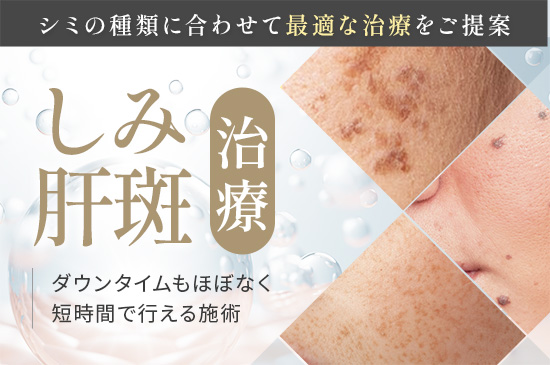 シミ・肝斑治療