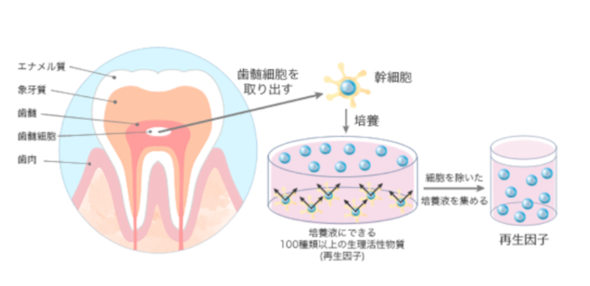 歯髄幹細胞培養上清液点滴療法