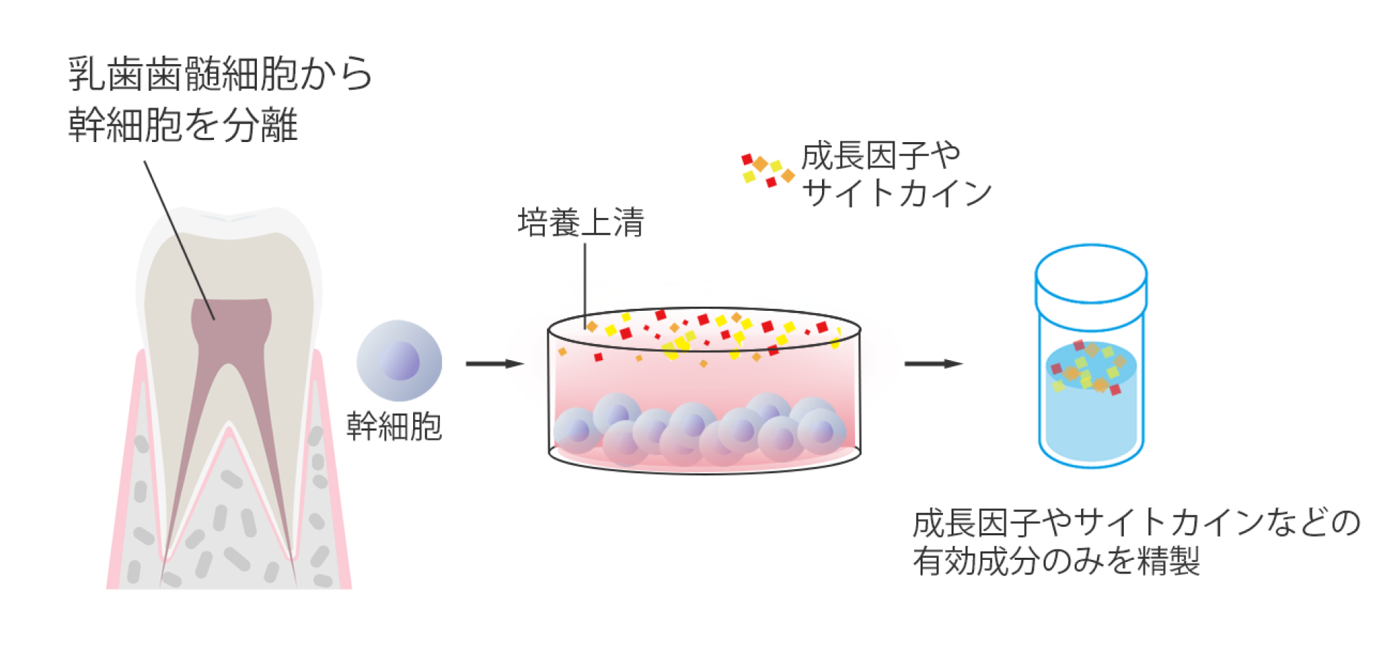 歯髄幹細胞治療とは