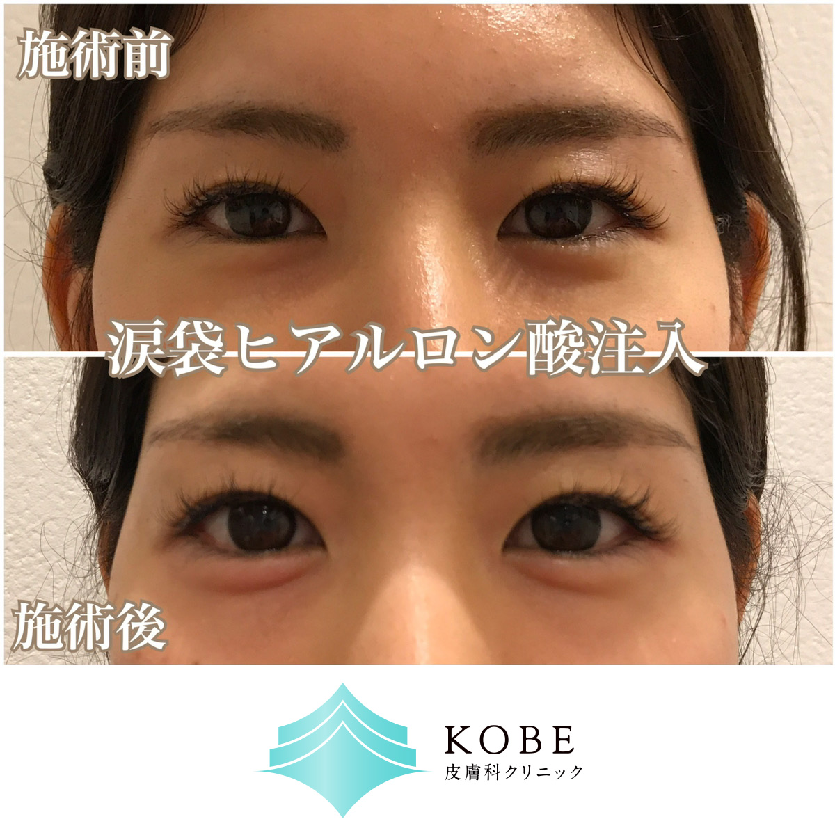 No.1142の症例写真
