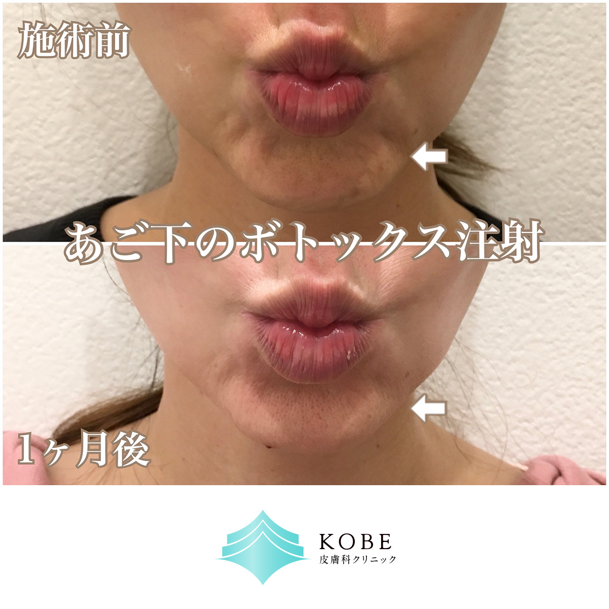 No.1506の症例写真
