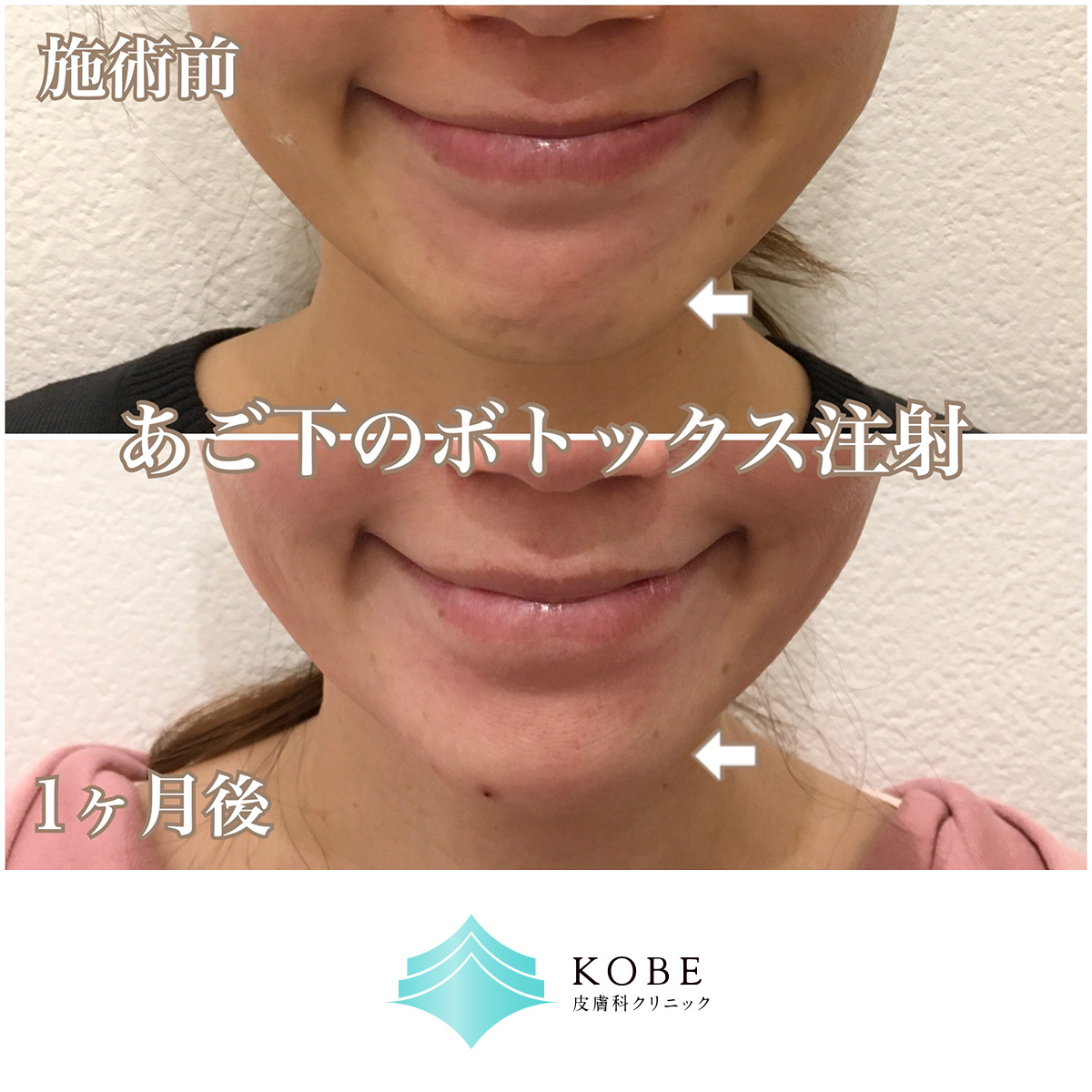 No.1528の症例写真