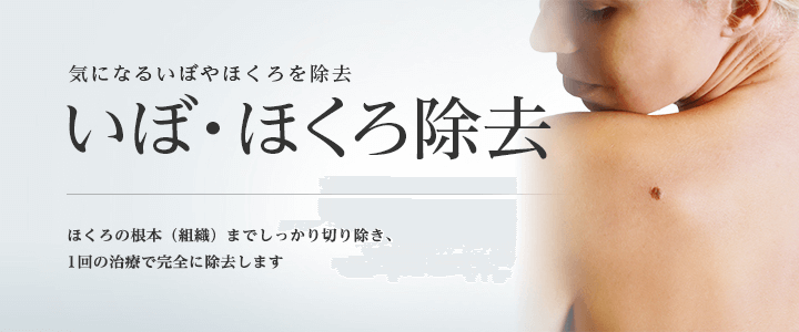 東京美容外科ほくろ除去東京ＦＶ
