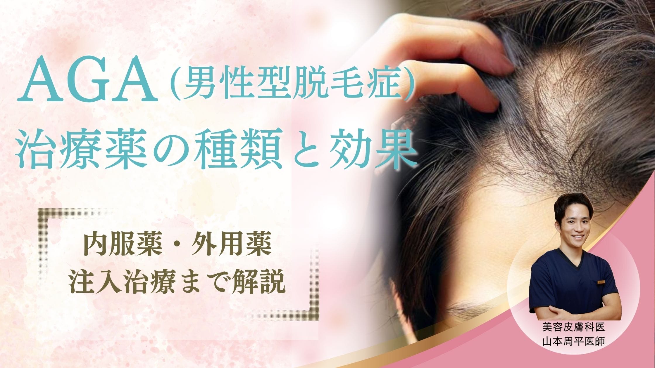 【医師が解説】AGA治療薬の種類と効果：内服薬・外用薬・注入治療まで徹底比較アイキャッチ