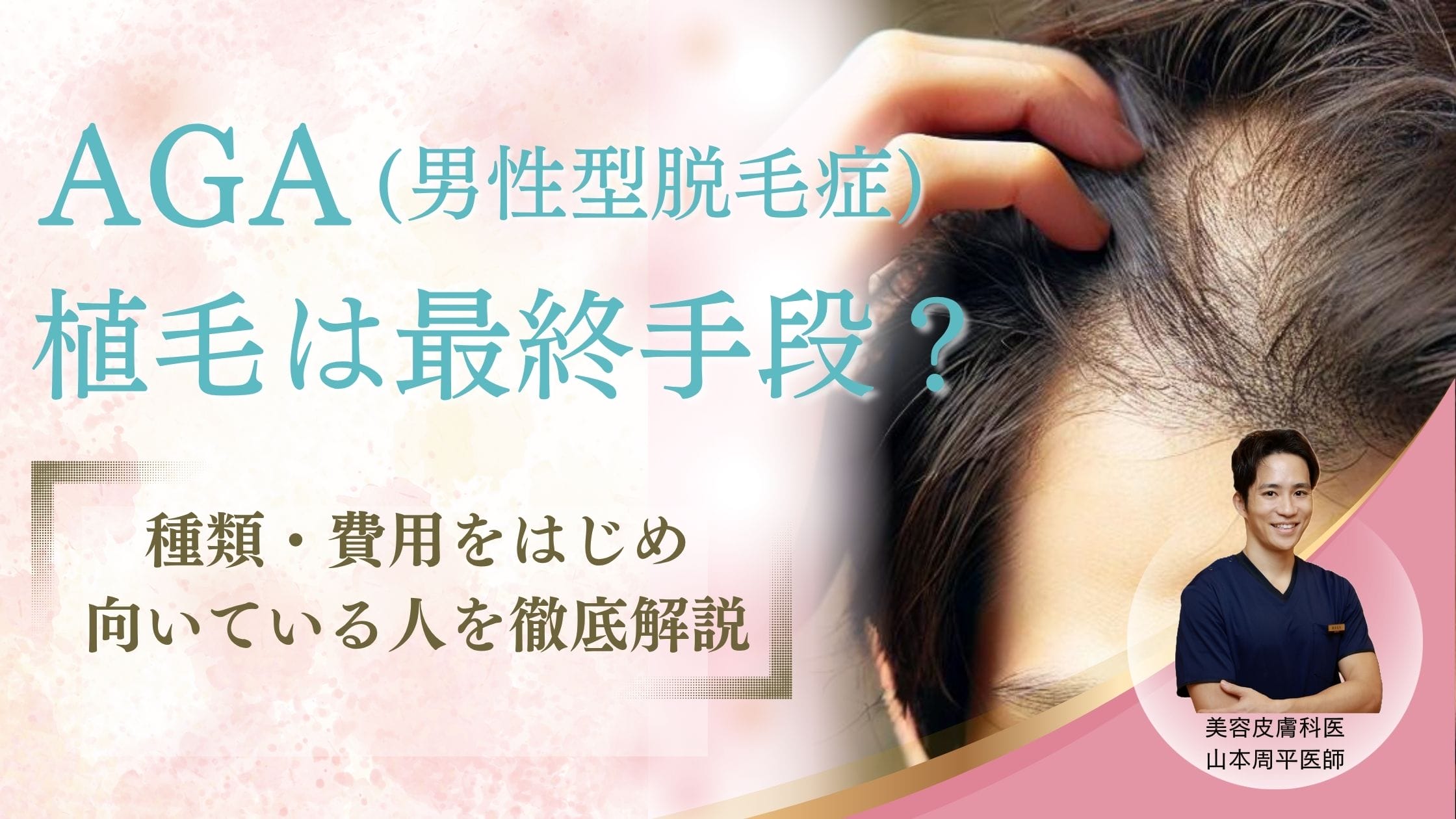 【医師監修】植毛はAGA治療の最終手段？種類・費用・向いている人を徹底解説アイキャッチ